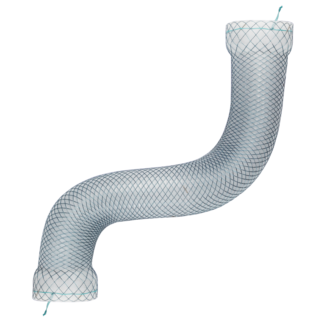 Esophageal Mega Stent